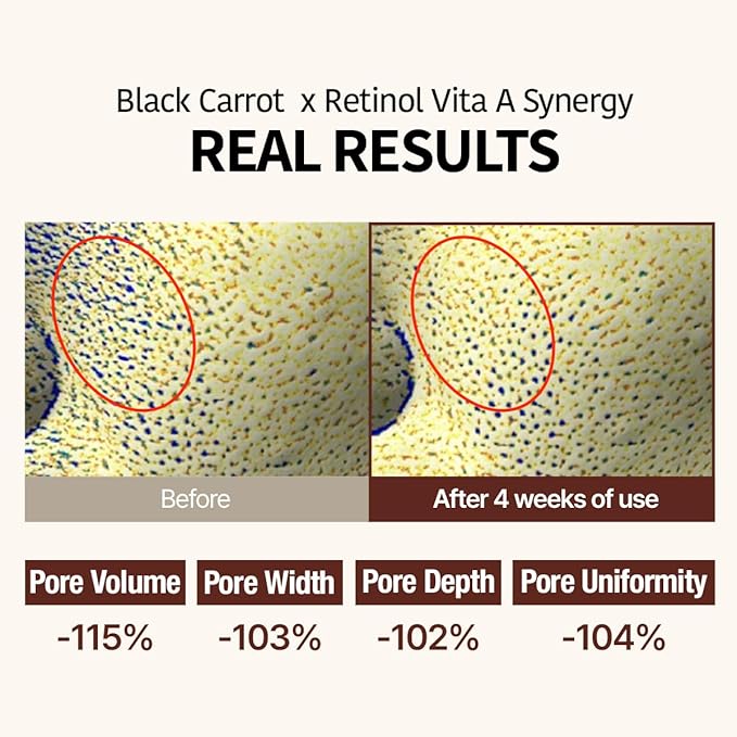 GOODAL Black Carrot VITA-A Retinol Ampoule 30ml, Hydration Facial Serum for Glowy Skin, Lightweight Serum, Korean Skincare, Pore minimizer-GlimoraGlow