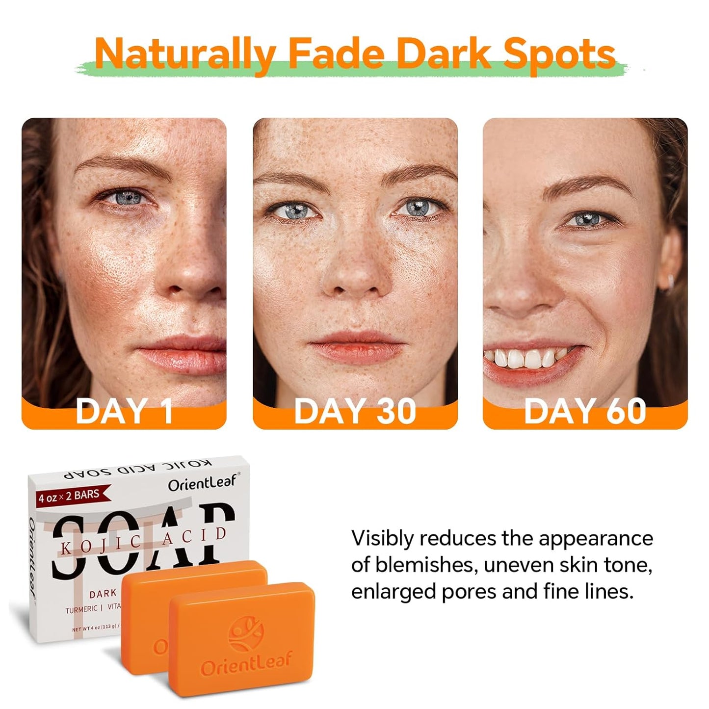 Kojic Acid and Turmeric Soap for Dark Spots Remover, Brightening, Hyperpigmentation for Face, 4oz x 2 BARS-GlimoraGlow