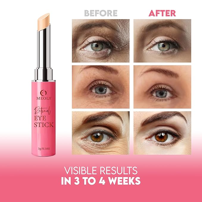 Instant Eye Bag Remover, Retinol Eye Cream for Dark Circles, Under Eye Brightener Stick, Under Eye Cream Anti Aging, Eye Cream for Wrinkles, Brightening Eye Cream for Puffiness and Bags-GlimoraGlow