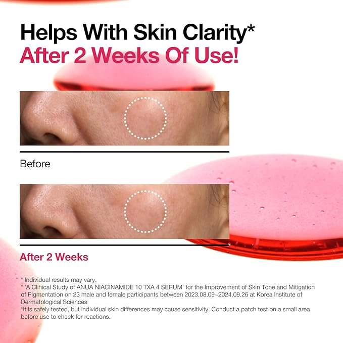 ANUA Niacinamide 10 + TXA 4 Serum, Hyaluronic Acid, Tranexamic acid, Facial Serum for Glass Skin, Clarifying, Radiant Complexion with Natural Color, Korean Skin Care (30ml /1.01 fl.oz)-GlimoraGlow