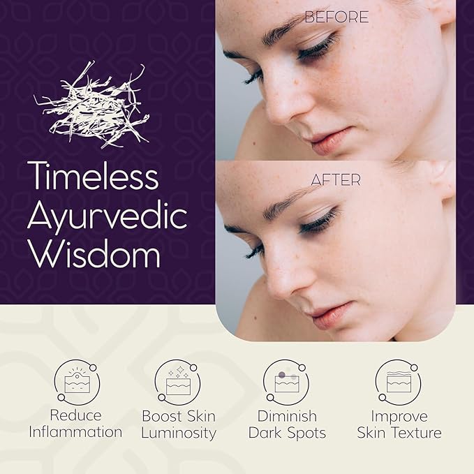 LUVIH Absolute Radiance Brightening Serum – Ayurvedic Dark Spot Corrector & Glow Serum for Women & Men – Nourishing Treatment for Dullness, Uneven Skin Tone & Sun-Stressed Skin – 30 mL-GlimoraGlow