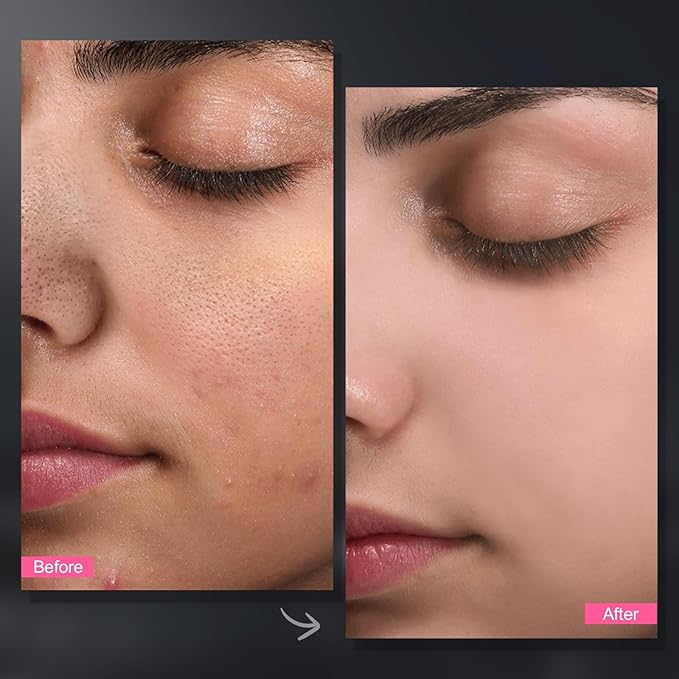 Carbonated Bubble Clay Mask -Exfoliation Face Mask | Detoxing Clay Mask for Blackhead Removal,Dull Skin,Skincare Facial Mask for Controlling Oil and Refining Pores,Mothers Day Gifts for Wife-GlimoraGlow