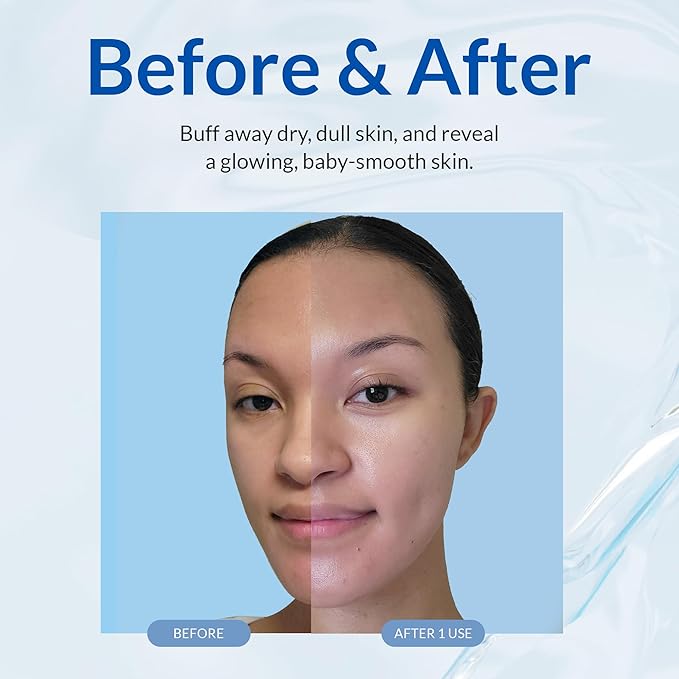 Cure by Toyo | Aqua Gel Gentle Exfoliator | Clear and Softer Skin | Non-Abrasive Face and Body Cleanser | Sensitive Skin | 3 Pack-GlimoraGlow