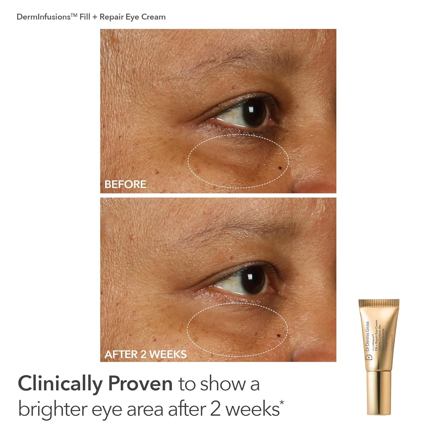 Dr. Dennis Gross Fill, Plump & Firm Kit – DermInfusions™ Hyaluronic Acid Serum, Eye Cream & Lip Treatment | Boost Hydration, Smooth Fine Lines & Enhance Volume | Limited Edition Gift Set-GlimoraGlow