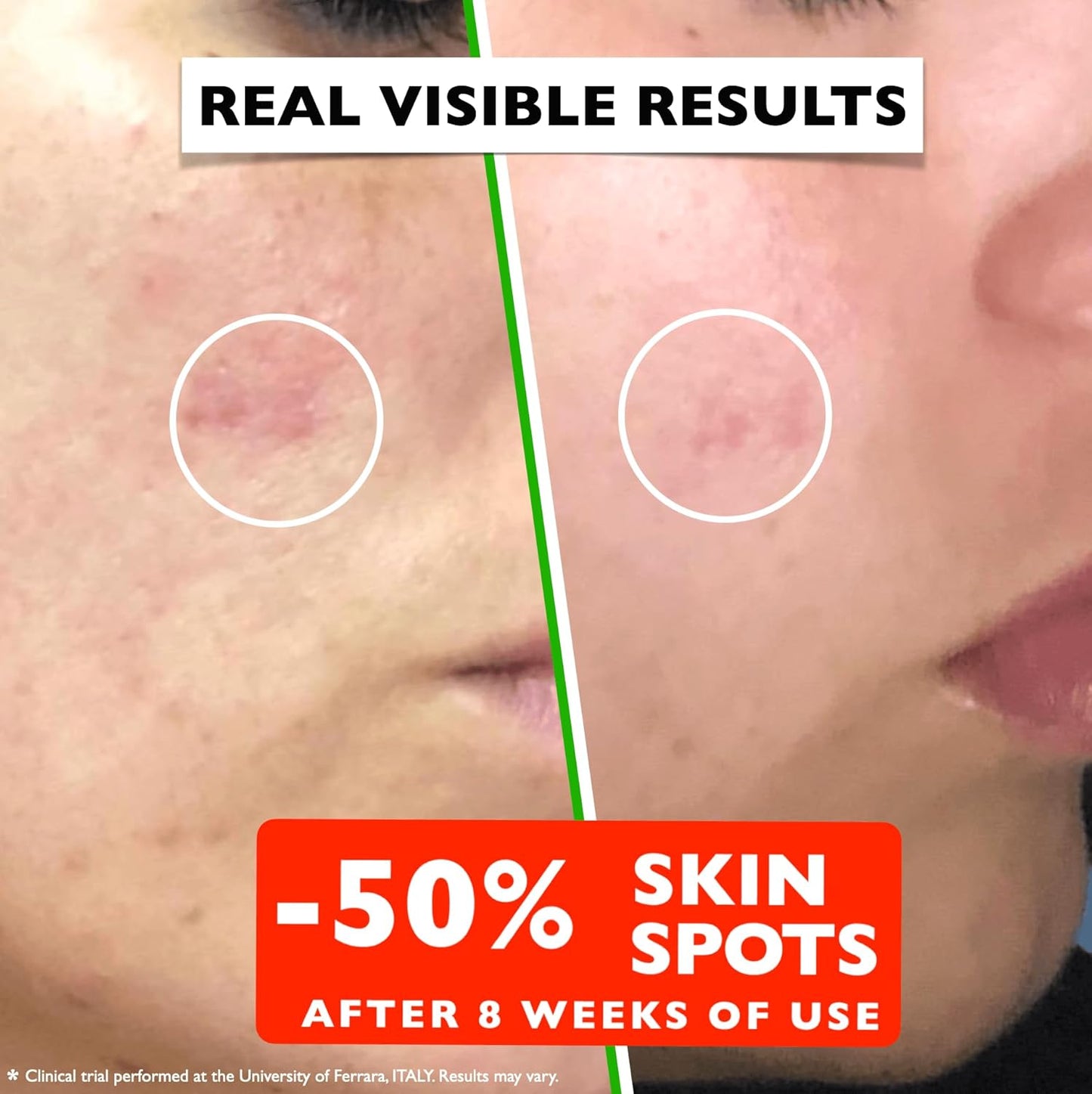 Vitamin C Serum For Face – Anti-Aging Facial Serum with Vitamin C, Hyaluronic Acid, Niacinamide, B5 & Vit E. Brightening Facial Essence for Dark Spots, Fine Lines, Wrinkles & Glowing Skin, 2 Fl Oz-GlimoraGlow