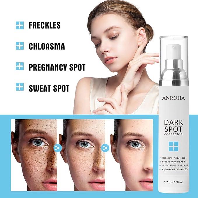 Face and Body Serum Promotes Anti-Aging Effect for Women and Men with Niacinamide,Kojic Acid & Salicyic Acid 50ml (Pack of 2)-GlimoraGlow