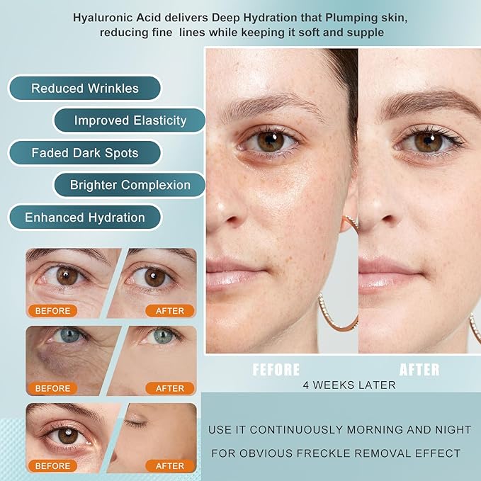 Vitamin C Serum for face with Hyaluronic Acid,Tri-Peptide Anti-Aging Facial Treatment for Mature Skin, Dark Spot Removal, Wrinkle Reduction, Firming, collagen-hydrating,antioxidant formula, 1 fl.oz-GlimoraGlow