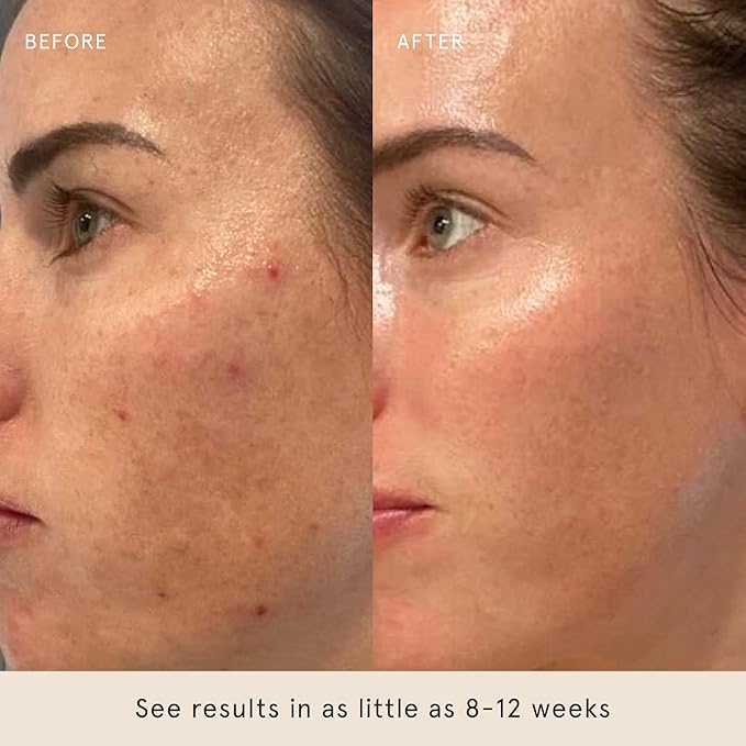 Barefaced Retinal Skin Therapy 30ml - Retinaldehyde & Bakuchiol Serum for Firming, Reducing Fine Lines & Wrinkles, Improving Skin Tone & Texture w/ Shea Butter, Jojoba Oil & Argan Oil-GlimoraGlow