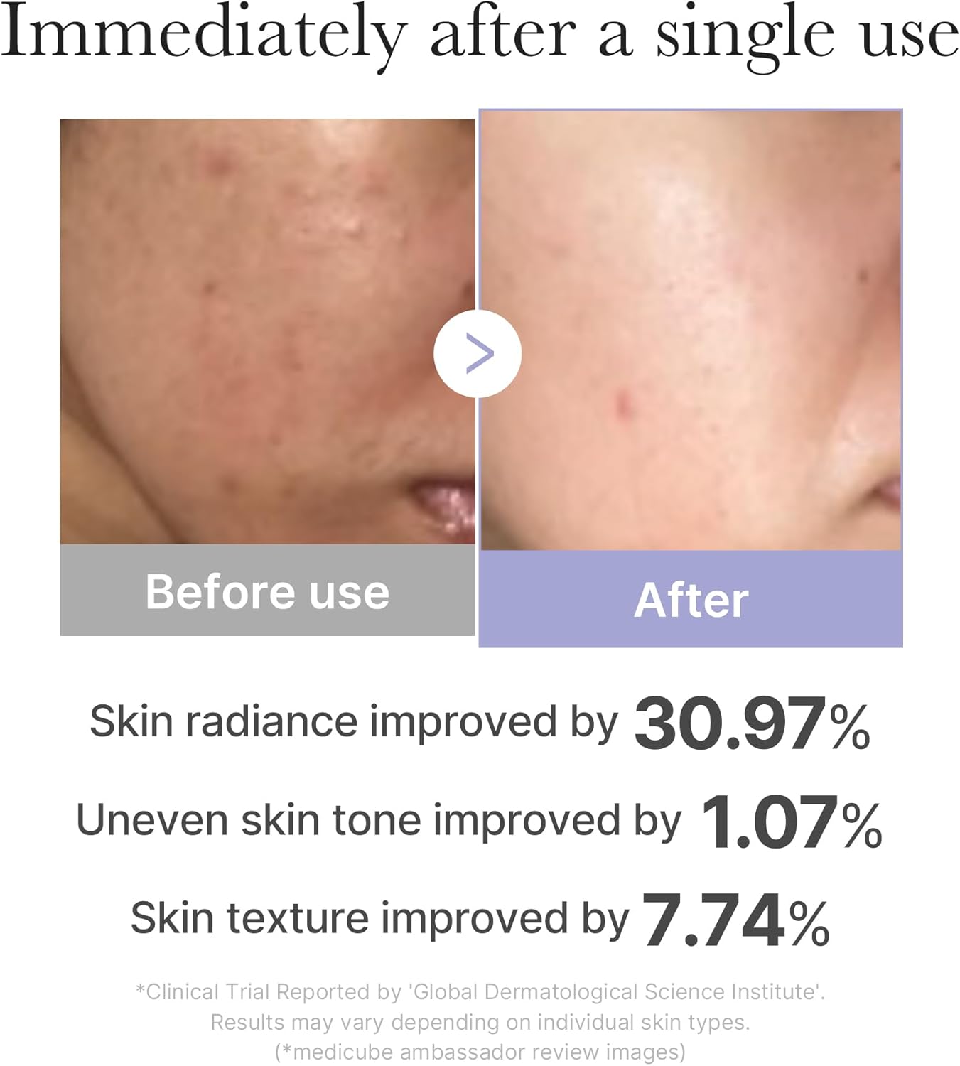 medicube Plump and Radiant Pink Duo: Mini Booster Pro Pink and Collagen Jelly Cream, 3.71 fl.oz. (110ml)-GlimoraGlow