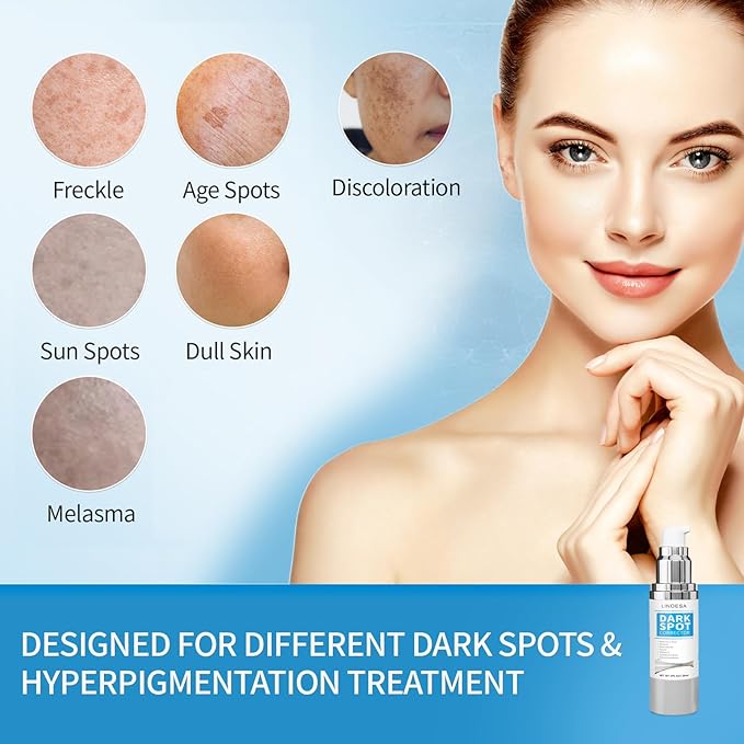Dark Spot Remover for Face,Dark Spot Corrector, Dark Spot Serum for Sun Spots, Age Spots, Brown Spots,Acne Scars,Melasma Brown Spot -Advanced Formula with Niacinamide Retinol for Women (1.0 Fl Oz)-GlimoraGlow