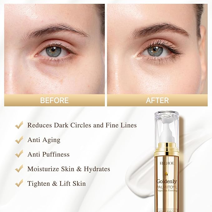 Caffeine Eye Serum Anti Aging, Eye Serum for Dark Circles and Puffiness, Retinol Eye Cream with 360°Massage Ball, Reduce Eye Wrinkles and Fine Lines-GlimoraGlow