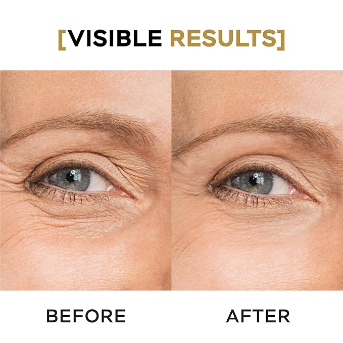 Moisturizing Eye Cream w/Aloe Vera, Collagen, Hyaluronic Acid, Cotton Stem Cells for Dark Circles, Puffiness & Bags - Under Eye Hydration Cream for Women & Men (1 Fl Oz)-GlimoraGlow