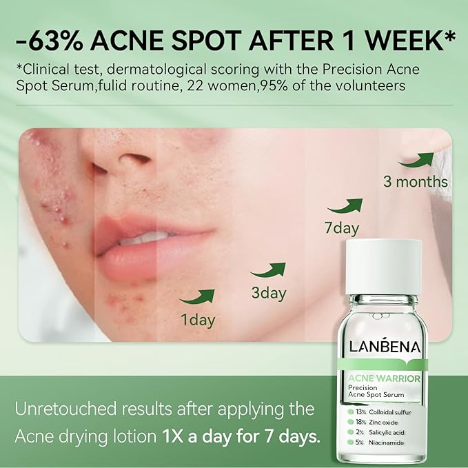 LANBENA Precision Acne Spot Serum, Acne Drying Lotion, Overnight Acne Treatment For Face, Dry Out Pimples, Blemishes, Zits And Clean Pores, 0.42 Fl Oz-GlimoraGlow