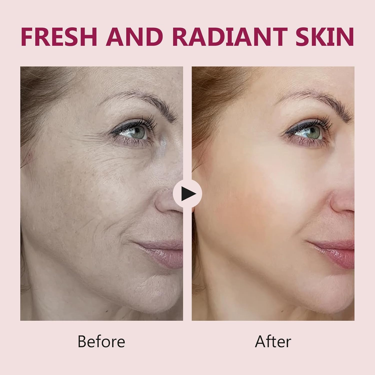 Salmon DNA Ampoule, Microneedling Serum, Anti-Wrinkle & Scar Removal for Face and Body, Salmon DNA Serum Ampoule Anti-wrinkle and Enhance Barrier Function-GlimoraGlow