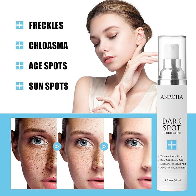 Dark Spot Remover for Face and Body Serum Promotes Anti-Aging Effect -Dark Spot Corrector for Women and Men with Niacinamide Kojic Acid & Salicyic Acid 50ml /1.7fl oz-GlimoraGlow