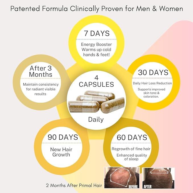 100% Natural Growth Treatment, Reduces Hair Loss, US Patented Formula Proven Effective for Men & Women, 100% Vegan Ingredients, Non-GMO, 30-Day Supply-GlimoraGlow