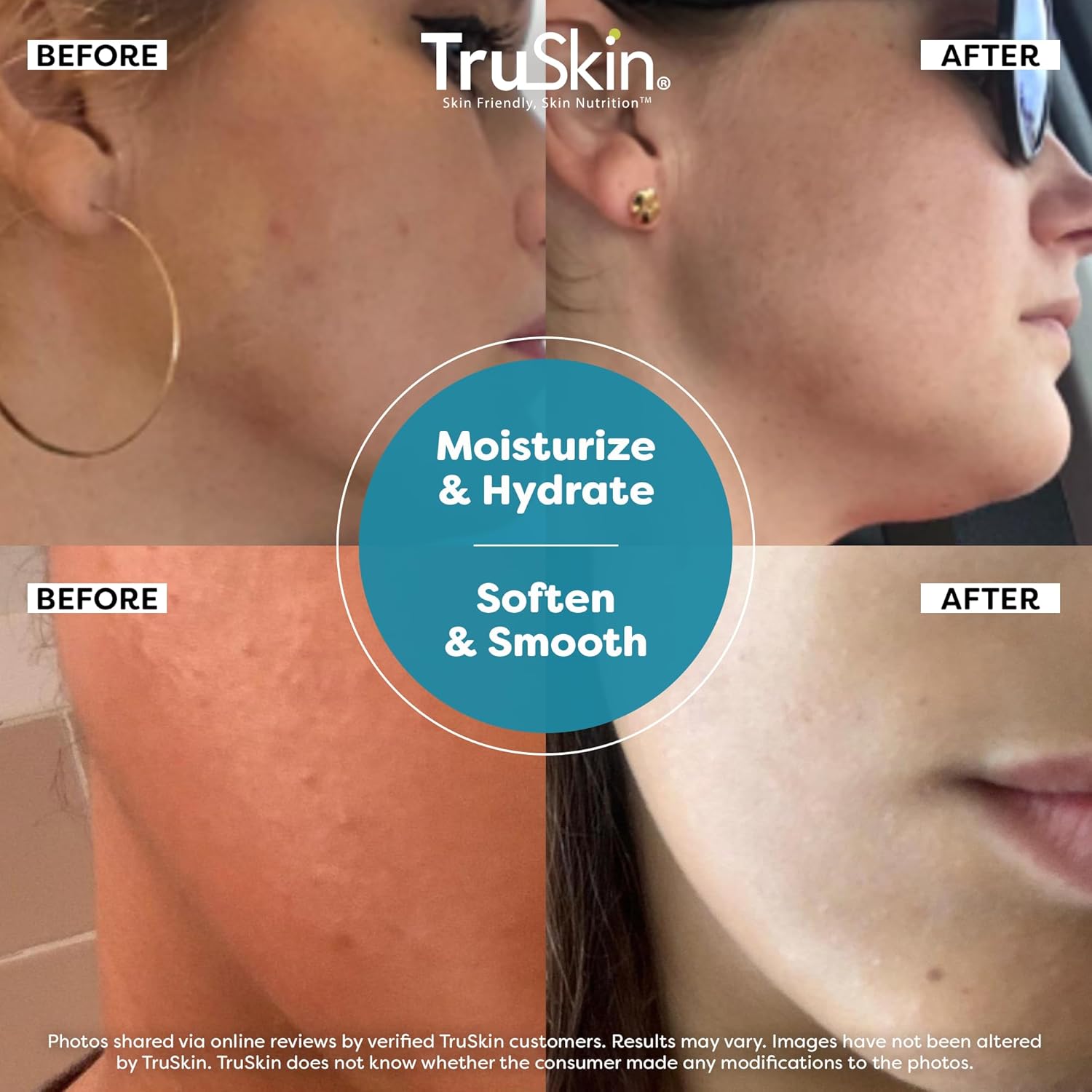 TruSkin Hyaluronic Acid Serum for Face + 7 Ultra Hydrating Ingredients – Best Face Serum for Moisturizing, Visibly Plumping Skin & Smoothing the Look of Fine Lines, 1 fl oz-GlimoraGlow