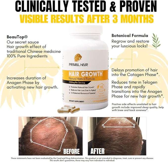 100% Natural Growth Treatment, Reduces Hair Loss, US Patented Formula Proven Effective for Men & Women, 100% Vegan Ingredients, Non-GMO, 30-Day Supply-GlimoraGlow
