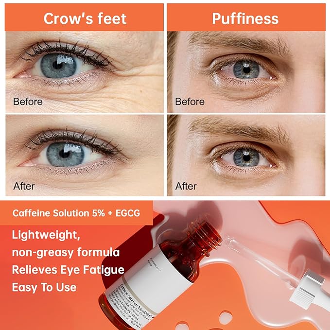 The Caffeine Solution 5% + EGCG，Reduces Appearance of Eye Contour Pigmentation and Puffiness，Under Eye Serum (30ml) Caffeine For Face Moisturizing Serum (1)-GlimoraGlow