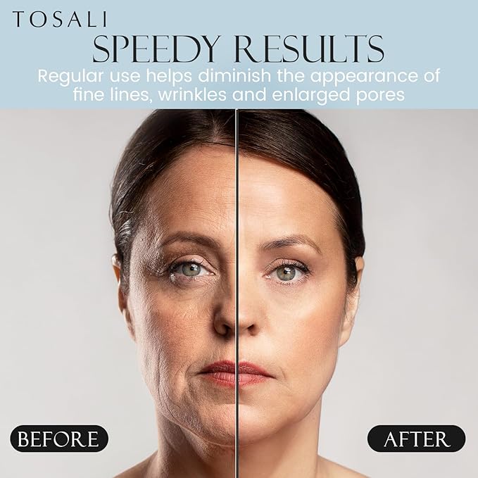 Anti Aging Daily Peeling Face Exfoliator – Peeling Gel with Hyaluronic Acid, Lactic Acid & Vitamin E, Gentle Exfoliating Gel for All Skin Types, Skin Care for Women, 6.8 Oz-GlimoraGlow