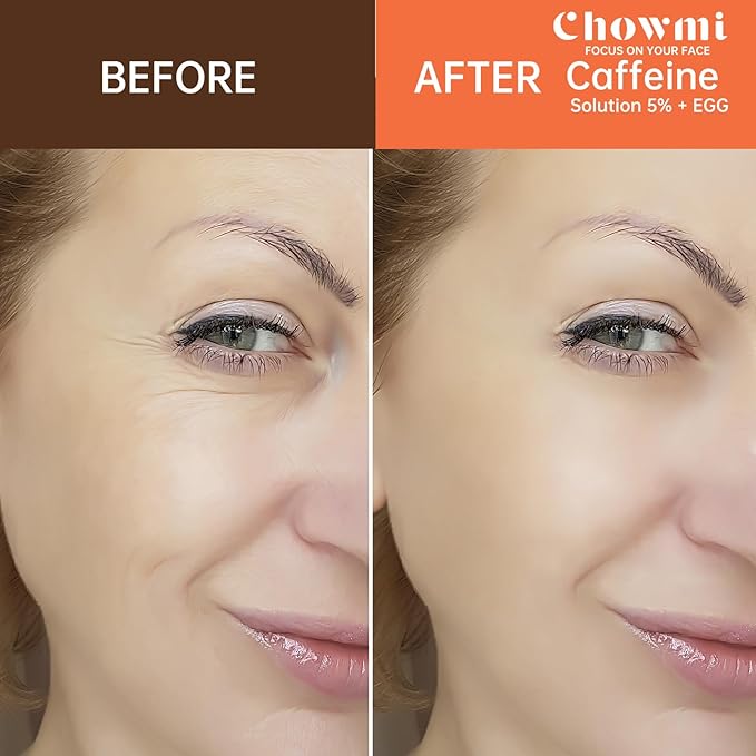 The Caffeine Solution 5% + EGCG，Reduces Appearance of Eye Contour Pigmentation and Puffiness，Under Eye Serum (30ml) Caffeine For Face Moisturizing Serum (2)-GlimoraGlow