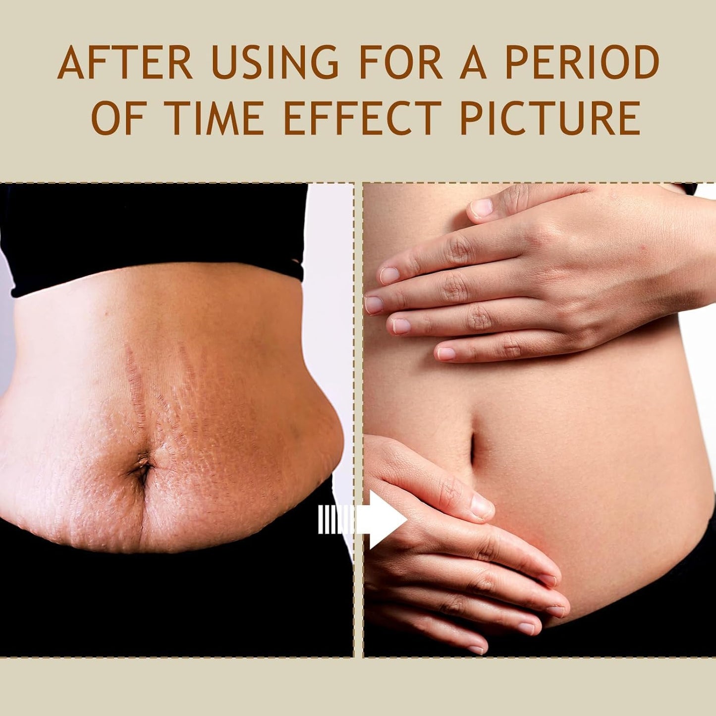 B Flat Belly Firming Cream - Stretch Mark Treatment - Clean and Gentle Belly Cream - Skin Tightening Cream for Cellulite for Stomach Mark & Thighs & Butt, Moisturizing Lifting Body Lotion-GlimoraGlow