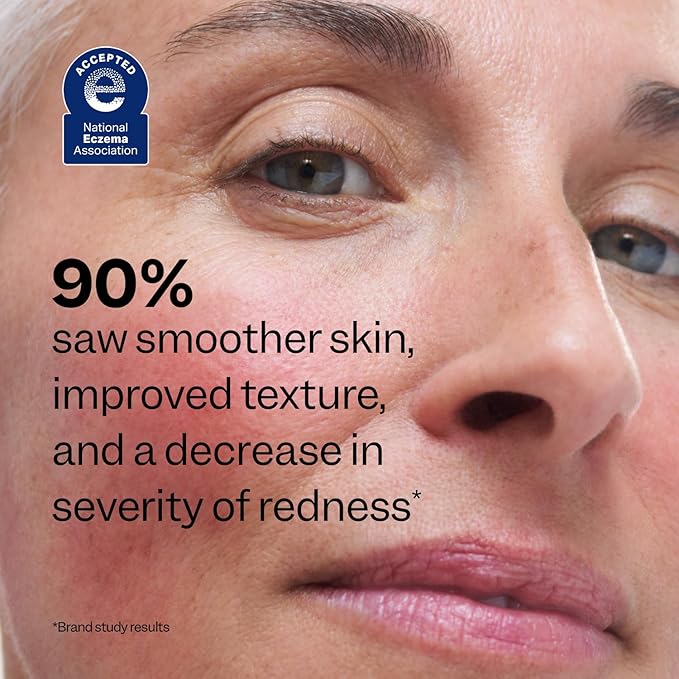 Peach Slices Redness Relief Azelaic Acid Serum-GlimoraGlow