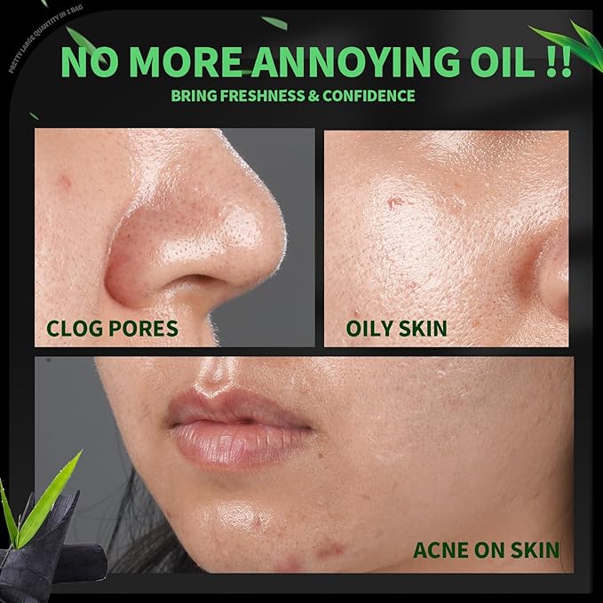 Blotting Paper for Oily Skin, Natural Bamboo Charcoal Blotting Paper, Oil Blotting Sheets for Face, 100 * 70MM Large Oil Absorbing Sheets Makeup Face Tissues, 200 Counts-GlimoraGlow