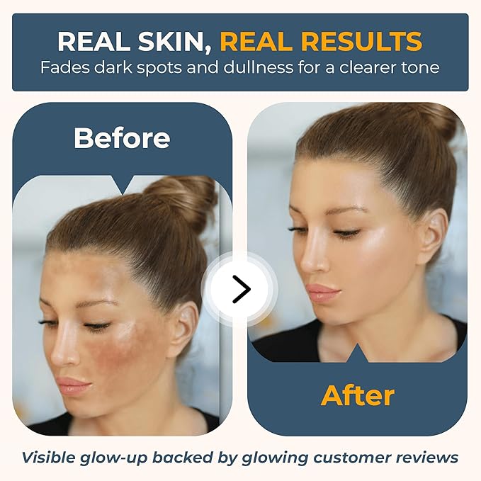 Vitabri Vitamin C Serum for Face – Brightening & Anti-Aging Formula with Vitamin C, Ferulic Acid & Botanicals – Hydrating Serum for Dark Spots, Tone & Fine Lines – 1 Fl Oz-GlimoraGlow