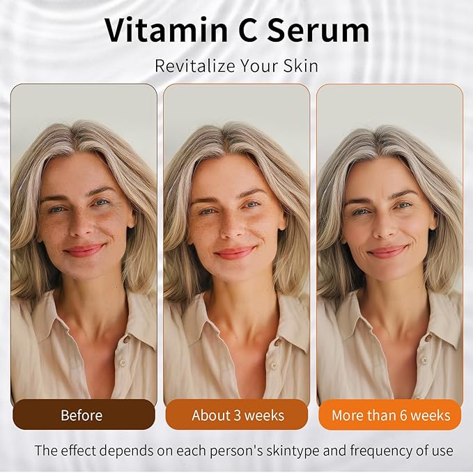 Vitamin C Retinol Serum for Face, Brightening & Anti-Aging with Hyaluronic Acid, Vitamin E, Peptides, Collagen - Hydrates, Firms, Lifts, Smooths, Targets Age Spots, Wrinkles, 1.7 Fl Oz-GlimoraGlow