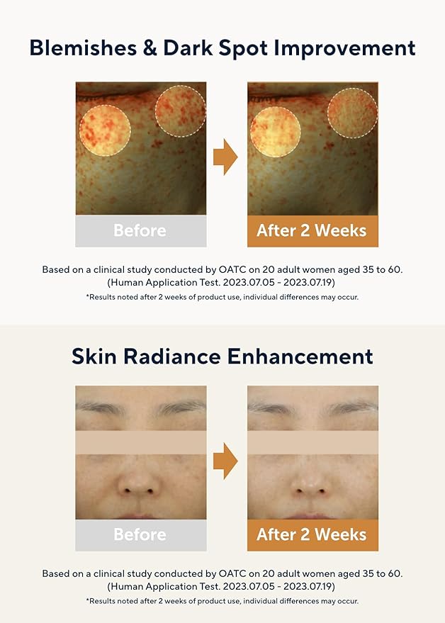 AROMATICA Glow Vita C Toning Serum Orange & Neroli 30ml/1.01 fl. oz - Orange Vitamin C Serum for Face with Hyaluronic Acid For Sensitive Skin-GlimoraGlow