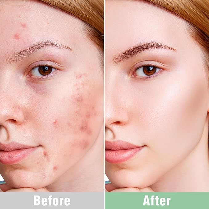 ISTON Overnight Hydrogel Face Mask for All Skin-GlimoraGlow