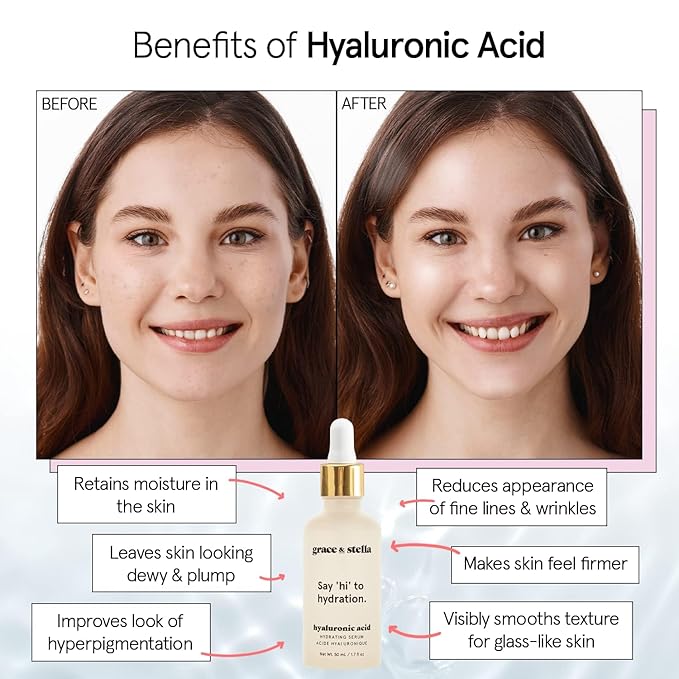 grace & stella Award Winning Hyaluronic Acid Serum (10ml/0.34 fl oz) Hyaluronic Acid Serum for Face - Acido Hialuronico Face Serums for Women - Hydrating, Remove Fine Lines, Wrinkles - Anti Aging-GlimoraGlow