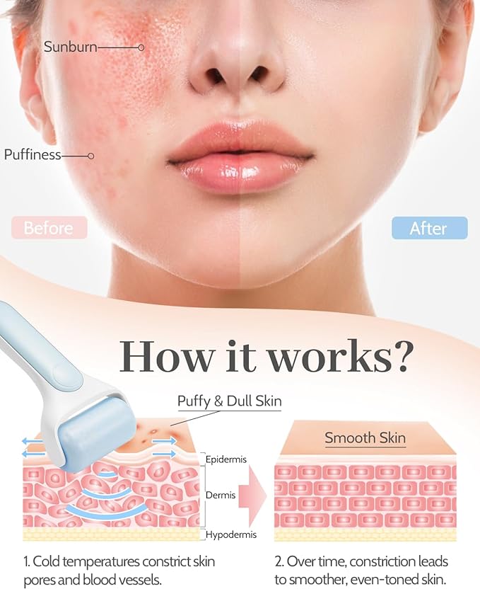 MORGLES Ice Roller for Face, Premium Facial Roller for Puffiness, Dark Circles and Lymphatic Drainage, Cold Face Roller for Women Self Care with Carry Case-GlimoraGlow