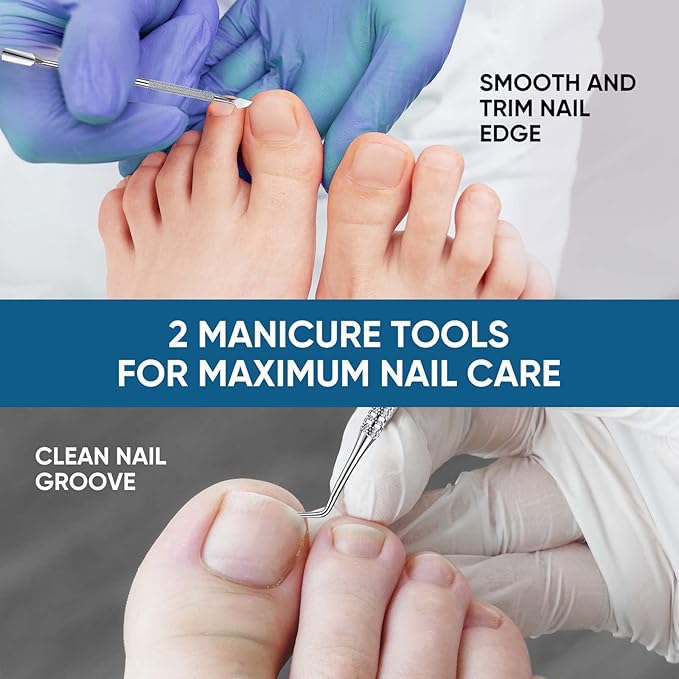 Ingrown Toenail Treatment, 60Pcs Ingrown Toenail Corrector Strips, Ingrown Toenail Removal Kit with File and Lifter, 60Pcs-GlimoraGlow