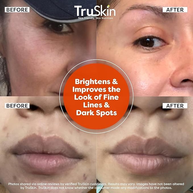 TruSkin Vitamin C Serum For Face – Anti Aging Face Serum with Vitamin C, Hyaluronic Acid, Vitamin E – Brightening Formula – Improve Appearance of Dark Spots, Tone, Fine Lines & Wrinkles, 1 Fl Oz-GlimoraGlow