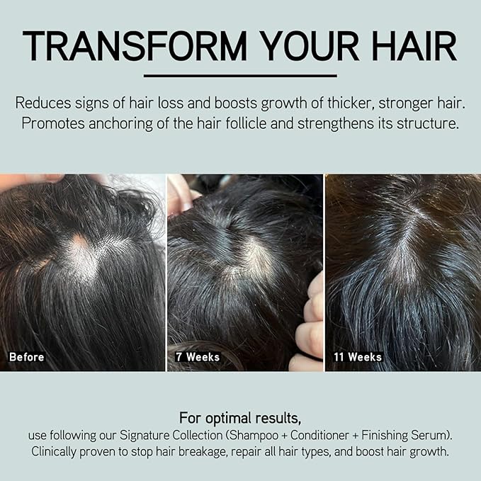 ILES FORMULA Scalp & Hair Rejuvenating Booster – Reduces Hair Loss Signs, Boosts Growth & Thickness, Botanically Derived Breakthrough Blend with Procapil, Tomato, Apple & Wasabi Extracts (1.7 Fl Oz)-GlimoraGlow