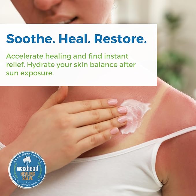 Waxhead Aftersun Body Butter for Sunburn Relief - Also great Tattoo Balm, Eczema Cream for Kids Adults, After Sun Lotion, Sunburn Treatment, Healing Salve-GlimoraGlow