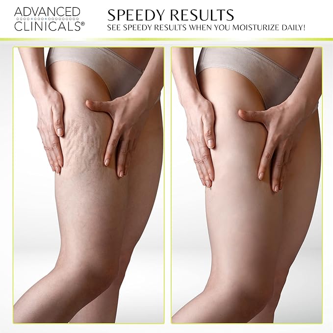 Advanced Clinicals Thermo Firming Green Coffee Bean Moisturizer Body Cream | Anti Cellulite Caffeine Firming Lotion For Legs, Arms, & Body | Skin Care Products | Aging Skin Tightening Cream, 2-Pack-GlimoraGlow