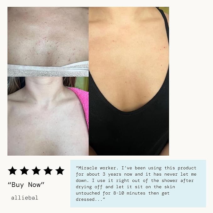 Pacifica Bacne Acne Cleanser Spray - Bacne Warrior - Body Spray for Acne Treatment - w/ 2% Salicylic Acid Niacinamide & Aloe - for Body, Chest & Back Acne for Teens & Adults Vegan Dermatologist Tested-GlimoraGlow