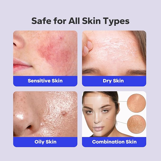 Salicylic Acid Spray (5.07 Fl Oz), 2% Salicylic Acid Body Spray, Body Acne Treatment for Bacne, Blackheads & Blemishes, Back & Chest Acne Spray for Face & Body, 360° Mist for All Skin Types-GlimoraGlow