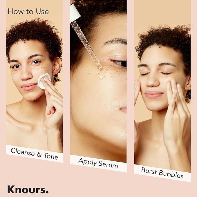 Knours. Balancing 5xHA+Gromwell Root oil Bubble Burst Serum w/ 59% Rose Water Niacinamide, Retinal Hydrating Healthy Serum for Improved Tone & Texture EWG Verified Clean Beauty 50ml/1.69fl. oz.-GlimoraGlow
