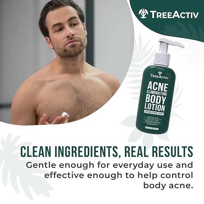 TreeActiv Acne Eliminating Body Lotion 8 fl oz | Clears Body, Back, Butt and Shoulder Acne | Anti-Acne Moisturizer | Prevents Future Breakouts | Cucumber Mint Scent-GlimoraGlow