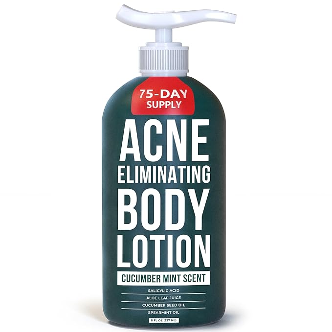 TreeActiv Acne Eliminating Body Lotion 8 fl oz | Clears Body, Back, Butt and Shoulder Acne | Anti-Acne Moisturizer | Prevents Future Breakouts | Cucumber Mint Scent-GlimoraGlow
