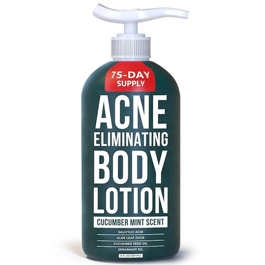 TreeActiv Acne Eliminating Body Lotion 8 fl oz | Clears Body, Back, Butt and Shoulder Acne | Anti-Acne Moisturizer | Prevents Future Breakouts | Cucumber Mint Scent-GlimoraGlow
