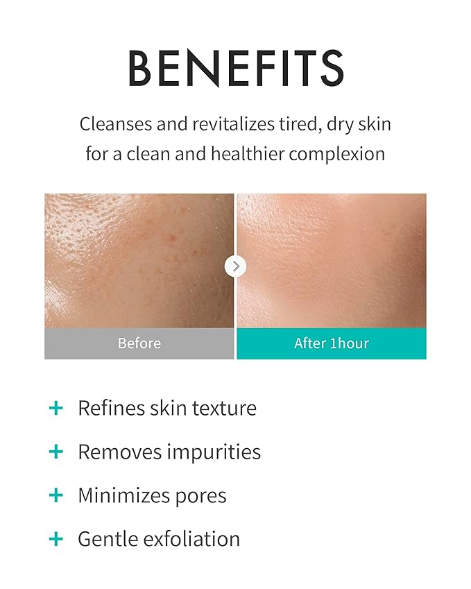 REJURAN® Refining Foam Cleanser, c-PDRN® – Hydrating & Gentle for Smoother, Clearer Skin, Minimizes Pores & Balances with Hyaluronic Acid & Tanin Complex, Korean Skin Care (4.05 fl oz)-GlimoraGlow