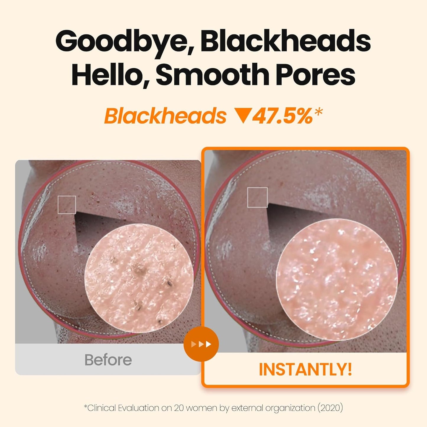 [K-Beauty] Calendula Biome Oil to Foam - All-in-One Korean Face Wash OilBased Foaming Facial Cleanser - Hydrating, Moisturizing & Soothing Makeup Deep Cleansing Oil for All Skin Types (3.88 fl oz)-GlimoraGlow