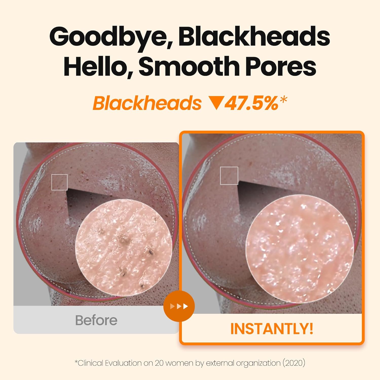 [K-Beauty] Calendula Biome Oil to Foam - All-in-One Korean Face Wash OilBased Foaming Facial Cleanser - Hydrating, Moisturizing & Soothing Makeup Deep Cleansing Oil for All Skin Types (3.88 fl oz)-GlimoraGlow