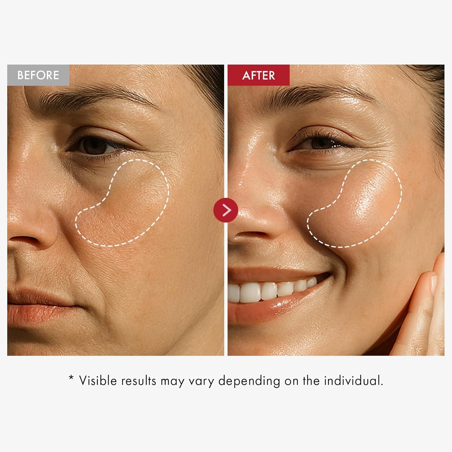 Real Collagen Face Cream, Face & Neck Collagen Face Moisturizer, Tightening, Firming, Lifting & Glow Boosting Cream with Collagen & Hyaluronic Acid, Korean Skincare, 50ml / 1.69 fl. oz.-GlimoraGlow