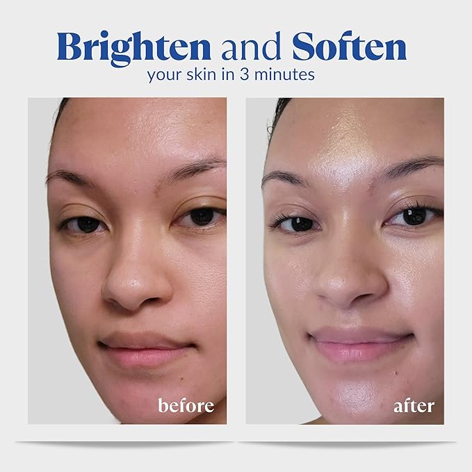 Cure by Toyo | Aqua Gel Gentle Exfoliator | Clear and Softer Skin | Non-Abrasive Face and Body Cleanser | Sensitive Skin | Big Size 8.82oz-GlimoraGlow